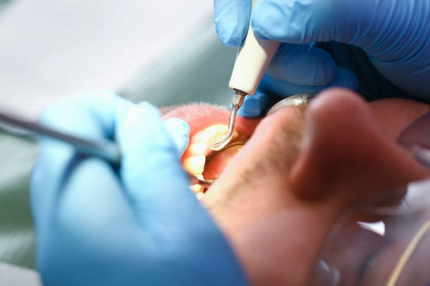Best Pediatric Emergency Dentist in Sandston, VA