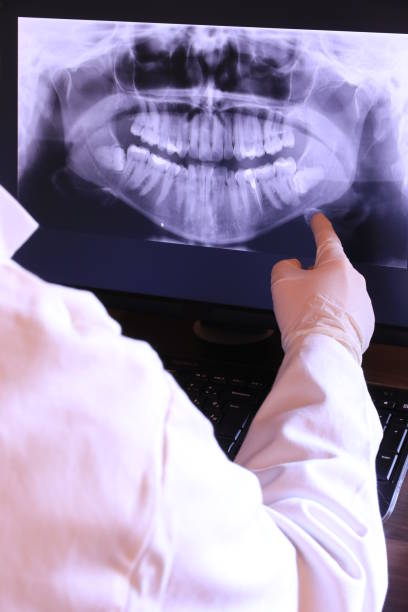 Best Emergency Tooth Extraction in Sandston, VA