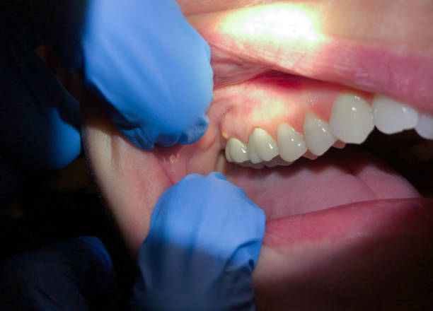Best Emergency Dental Care for Trauma or Injury in Sandston, VA